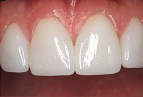 Granger Dentistry | Orthodontics, CEREC and CBCT